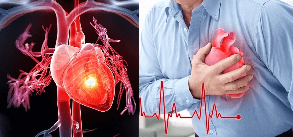 Chạy Bộ Có Tác Dụng Gì: 9 Lợi Ích Khi Chạy Bộ Mỗi Ngày 3
