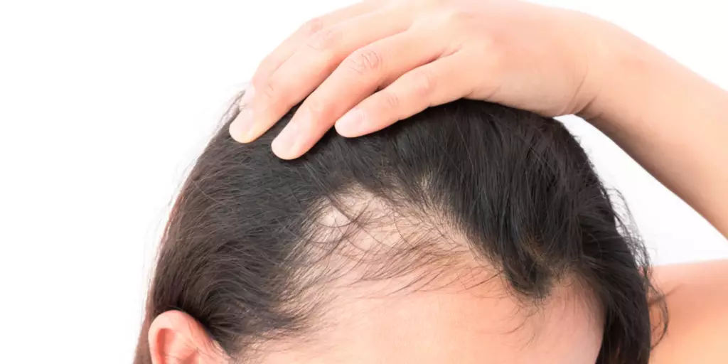 13 Hậu Quả Của Giảm Cân Nhanh Cực Kỳ Nguy Hiểm 7