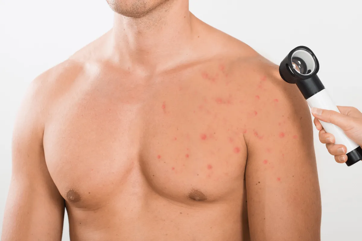 9 Tác Dụng Phụ Của Mass Tăng Cân Gây Hại Nghiêm Trọng 3