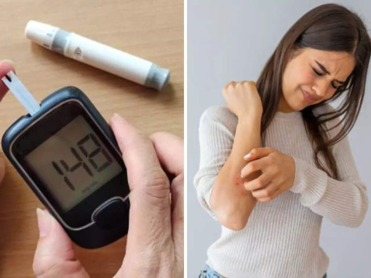 Tích Mỡ Bụng: Nguyên Nhân Và 7 Rủi Ro Đe Dọa Sức Khỏe 5 Tích Mỡ Bụng: Nguyên Nhân Và 7 Rủi Ro Đe Dọa Sức Khỏe 5